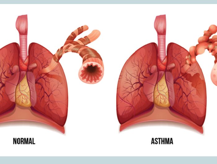 Homeopathy Treatment For Asthma